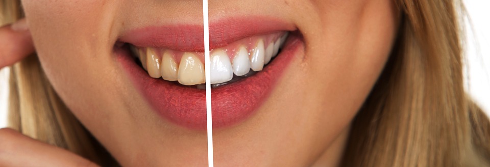 Wieder richtig lachen können- Zahnzusatzversicherung